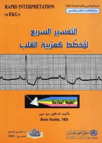 التفسير السريع لمخطط كهربية القلب